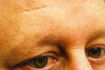 Male Eyebrow example 1 before